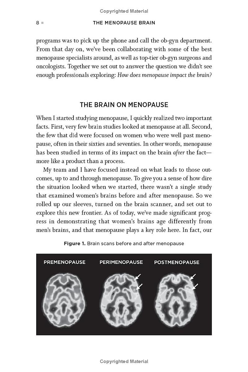The Menopause Brain by Lisa Mosconi, PhD