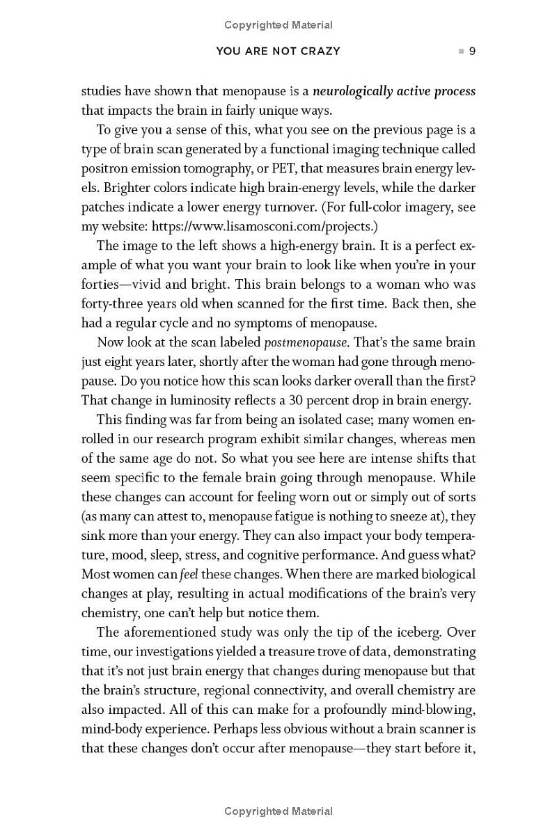 The Menopause Brain by Lisa Mosconi, PhD